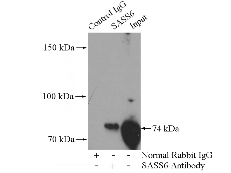 IP Result of anti-SASS6 (IP:Catalog No:114974, 4ug; Detection:Catalog No:114974 1:1000) with HeLa cells lysate 600ug.