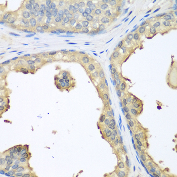 Immunohistochemistry - GPI Polyclonal Antibody 