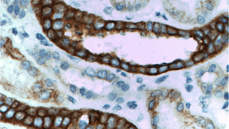 Immunohistochemistry of paraffin-embedded human kidney tissue slide using Catalog No:107231(KRT18 Antibody) at dilution of 1:1200 (under 40x lens). Heat mediated antigen retrieved with Citric acid buffer, pH6.0