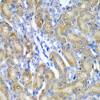 Immunohistochemistry - CRYAA Polyclonal Antibody 