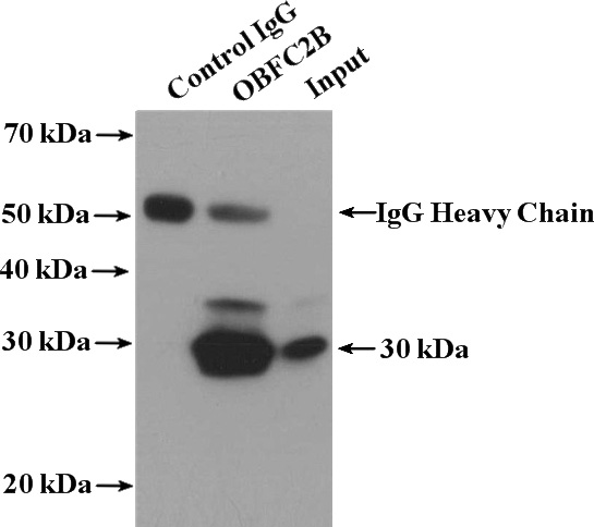 IP Result of anti-OBFC2B (IP:Catalog No:113464, 4ug; Detection:Catalog No:113464 1:500) with HeLa cells lysate 3200ug.