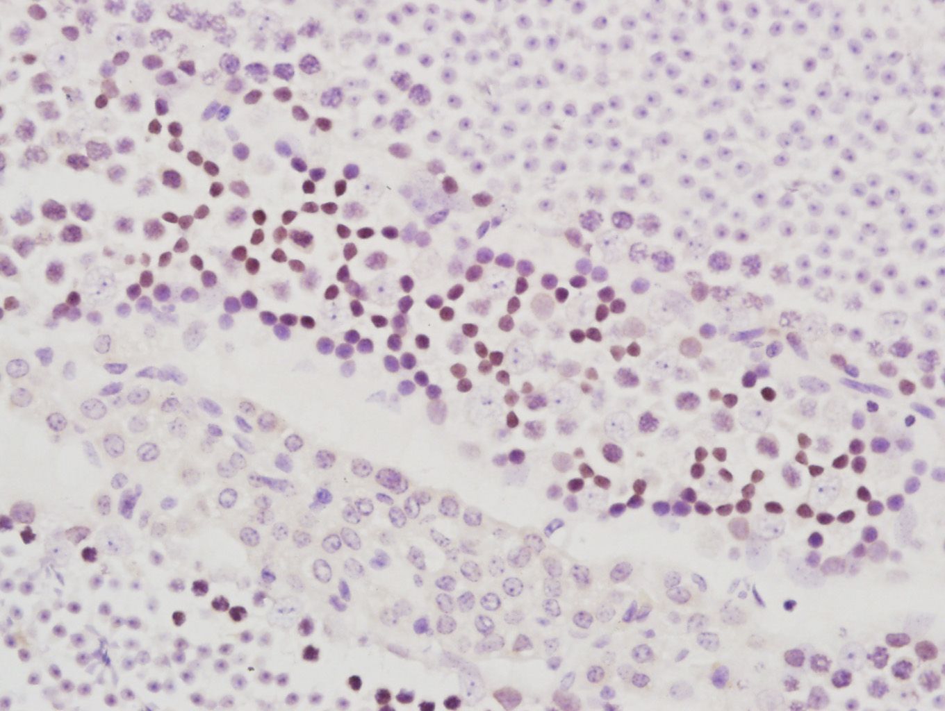 Fig2: Paraformaldehyde-fixed, paraffin embedded (Mouse testis); Antigen retrieval by boiling in sodium citrate buffer (pH6.0) for 15min; Block endogenous peroxidase by 3% hydrogen peroxide for 20 minutes; Blocking buffer (normal goat serum) at 37℃ for 30min; Antibody incubation with (NARG1) Polyclonal Antibody, Unconjugated at 1:400 overnight at 4℃, followed by a conjugated secondary antibody (sp-0023) for 20 minutes and DAB staining.