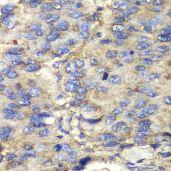 Immunohistochemistry - SDHA Polyclonal Antibody 