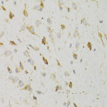 Immunohistochemistry - KISS1R Polyclonal Antibody 