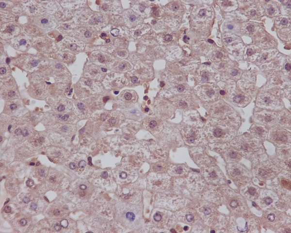 Immunohistochemical analysis of paraffin-embedded human liver, using Notch1 Antibody .