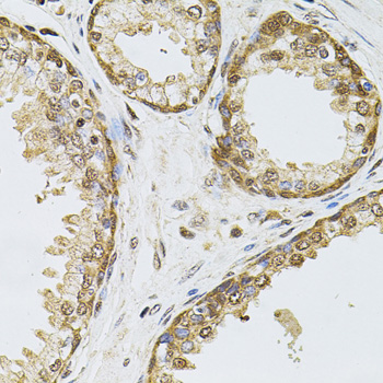Immunohistochemistry - POP4 Polyclonal Antibody 