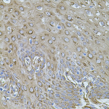 Immunohistochemistry - FLNB Polyclonal Antibody 