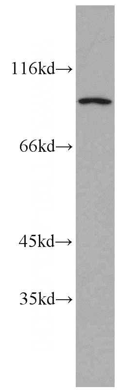 HepG2 cells were subjected to SDS PAGE followed by western blot with Catalog No:109224(CHFR antibody) at dilution of 1:1000