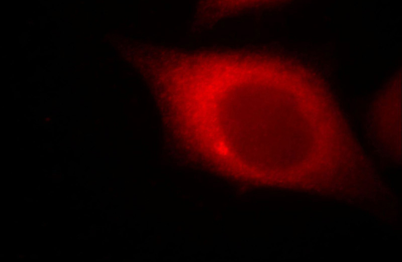 Immunofluorescent analysis of MCF-7 cells, using CTAGE1 antibody Catalog No: at 1:25 dilution and Rhodamine-labeled goat anti-mouse IgG (red).