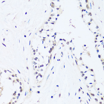 Immunohistochemistry - BRIX1 Polyclonal Antibody 
