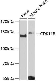 Western blot - CDK11B Polyclonal Antibody 