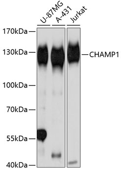 Western blot - CHAMP1 Polyclonal Antibody 