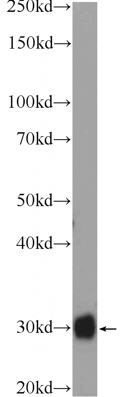 mouse heart tissue were subjected to SDS PAGE followed by western blot with Catalog No:110652(FHL5 Antibody) at dilution of 1:2000