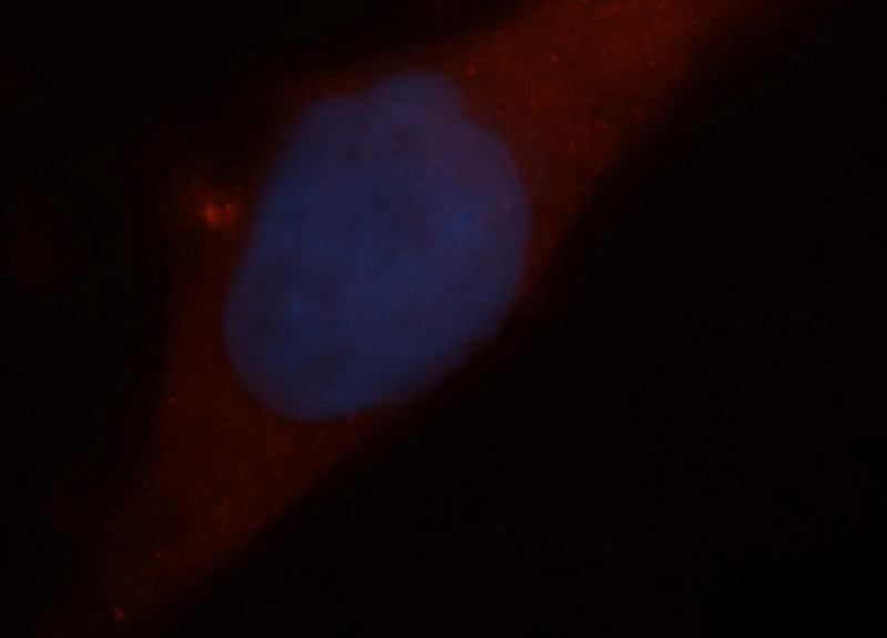 Immunofluorescent analysis of MCF-7 cells, using ARD1A antibody Catalog No:108240 at 1:50 dilution and Rhodamine-labeled goat anti-rabbit IgG (red). Blue pseudocolor = DAPI (fluorescent DNA dye).