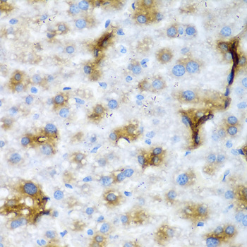 Immunohistochemistry - NCL Polyclonal Antibody 