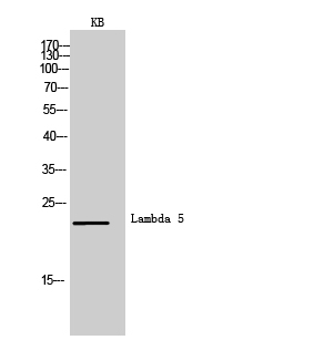 Fig1:; Western Blot analysis of KB cells using Lambda 5 Polyclonal Antibody.. Secondary antibody（catalog#: HA1001) was diluted at 1:20000