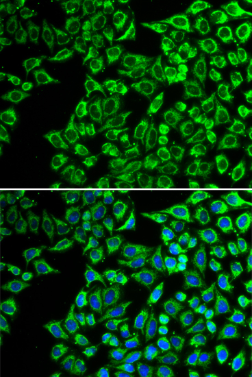 Immunofluorescence - LIPC Polyclonal Antibody 