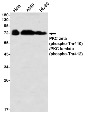 Western blot detection of PKC zeta (phospho-Thr410)/PKC lambda (phospho-Thr412) in Hela,A549,HL-60 using PKC zeta (phospho-Thr410)/PKC lambda (phospho-Thr412) Rabbit mAb(1:1000 diluted)