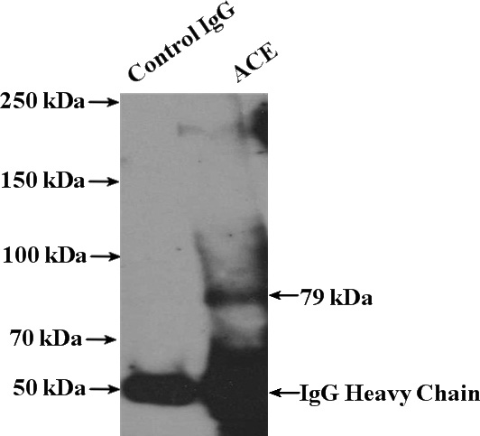 IP Result of anti-ACE (IP:Catalog No:107735, 4ug; Detection:Catalog No:107735 1:1000) with mouse heart tissue lysate 4000ug.