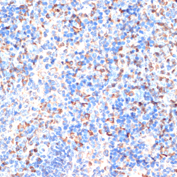 Immunohistochemistry - EMR1 Polyclonal Antibody 