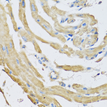 Immunohistochemistry - SFRP4 Polyclonal Antibody 