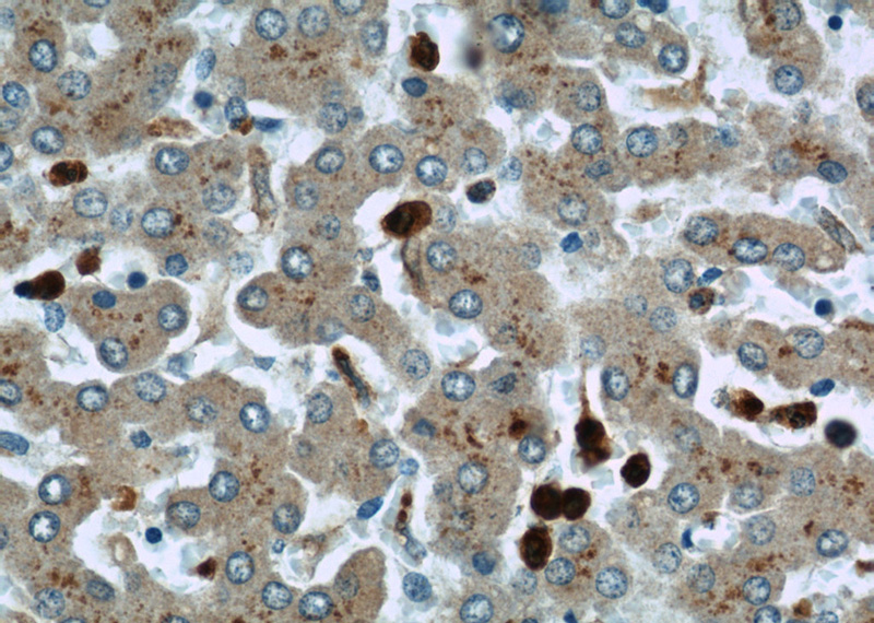 Immunohistochemical of paraffin-embedded human liver using Catalog No:112746(MPO antibody) at dilution of 1:50 (under 40x lens)