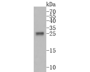 Fig1:; Western blot analysis of PRSS2 on human small intestine tissue lysates. Proteins were transferred to a PVDF membrane and blocked with 5% BSA in PBS for 1 hour at room temperature. The primary antibody ( 1/500) was used in 5% BSA at room temperature for 2 hours. Goat Anti-Rabbit IgG - HRP Secondary Antibody (HA1001) at 1:5,000 dilution was used for 1 hour at room temperature.
