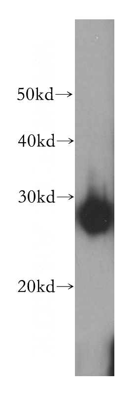 HeLa cells were subjected to SDS PAGE followed by western blot with Catalog No:111565(HSPB1 antibody) at dilution of 1:500