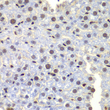 Immunohistochemistry - LHX4 Polyclonal Antibody 