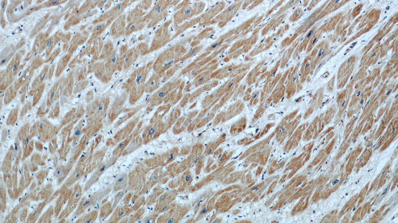 Immunohistochemical of paraffin-embedded human heart using Catalog No:108056(ANGPTL2 antibody) at dilution of 1:50 (under 10x lens)