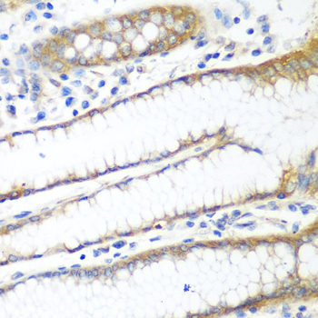 Immunohistochemistry - PPP4R1 Polyclonal Antibody 