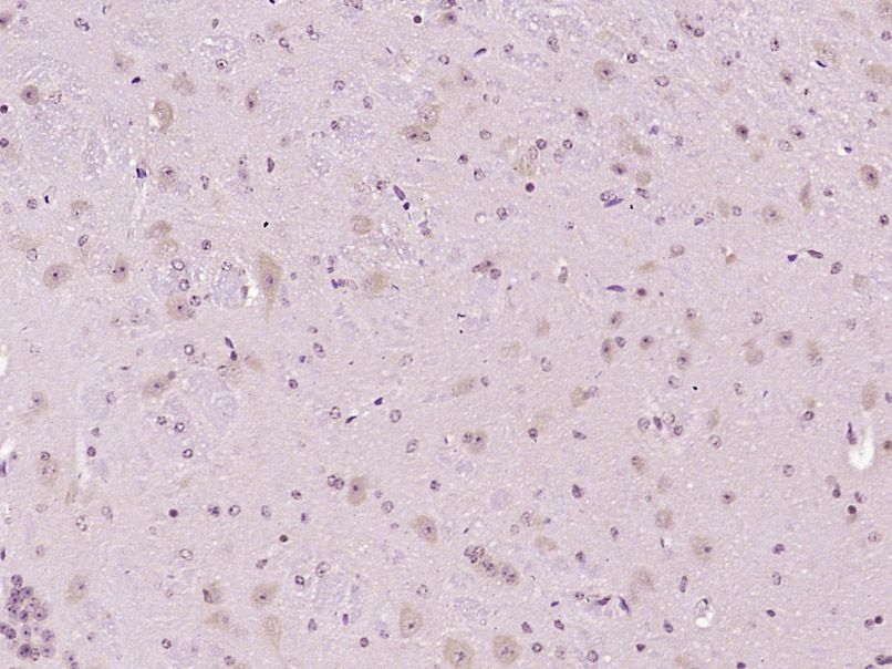Fig3: Paraformaldehyde-fixed, paraffin embedded (Mouse brain); Antigen retrieval by boiling in sodium citrate buffer (pH6.0) for 15min; Block endogenous peroxidase by 3% hydrogen peroxide for 20 minutes; Blocking buffer (normal goat serum) at 37℃ for 30min; Antibody incubation with (NPFF1 Receptor) Polyclonal Antibody, Unconjugated at 1:400 overnight at 4℃, followed by operating according to SP Kit(Rabbit) (sp-0023) instructionsand DAB staining.