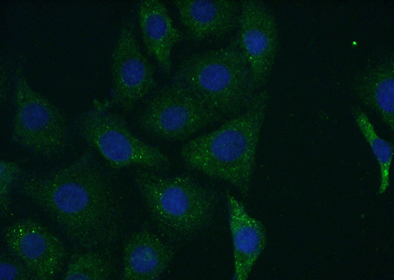 Immunofluorescent analysis of (-20oc Acetone) fixed SH-SY5Y cells using Catalog No:109912(DGKH Antibody) at dilution of 1:50 and Alexa Fluor 488-congugated AffiniPure Goat Anti-Rabbit IgG(H+L)