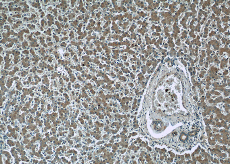 Immunohistochemistry of paraffin-embedded human liver slide using Catalog No:111197(GRB10 Antibody) at dilution of 1:50