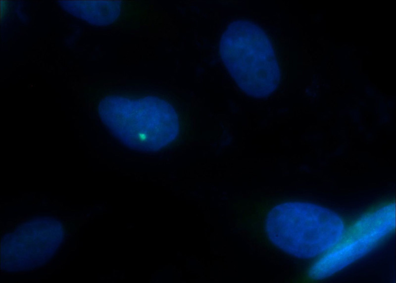 Immunofluorescent analysis of MDCK cells using Catalog No:115028(SDCCAG8 Antibody) at dilution of 1:50 and Alexa Fluor 488-congugated AffiniPure Goat Anti-Rabbit IgG(H+L)