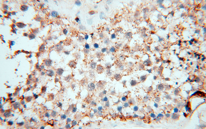 Immunohistochemical of paraffin-embedded human testis using Catalog No:110222(EHBP1 antibody) at dilution of 1:100 (under 40x lens)