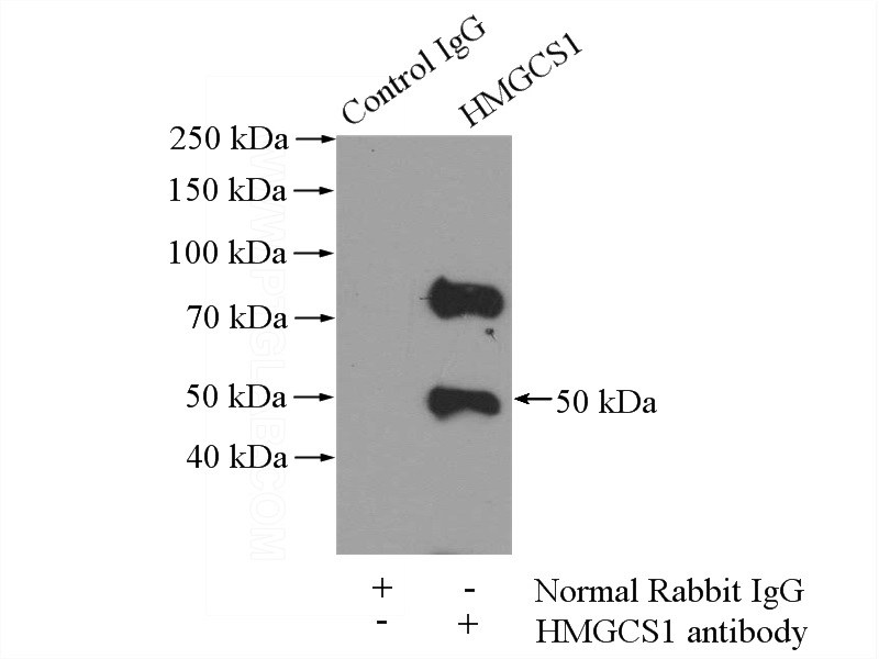 IP Result of anti-HMGCS1 (IP:Catalog No:111485, 3ug; Detection:Catalog No:111485 1:1000) with mouse liver tissue lysate 4000ug.