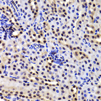 Immunohistochemistry - GABPB1 Polyclonal Antibody 