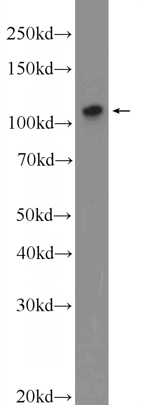 mouse testis tissue were subjected to SDS PAGE followed by western blot with Catalog No:117026(ZNF711 Antibody) at dilution of 1:300