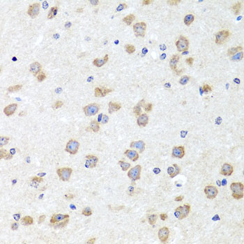 Immunohistochemistry - CHD1 Polyclonal Antibody 