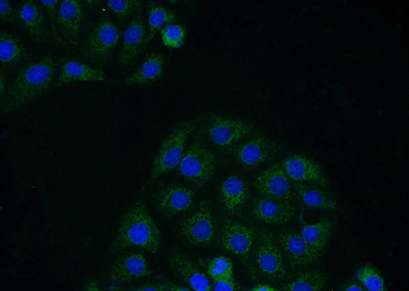 Immunofluorescent analysis of SH-SY5Y cells using Catalog No:113561(NGFR Antibody) at dilution of 1:25 and Alexa Fluor 488-congugated AffiniPure Goat Anti-Rabbit IgG(H+L)