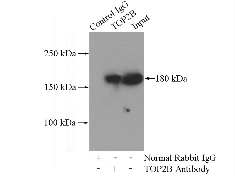 IP Result of anti-TOP2B (IP:Catalog No:116248, 4ug; Detection:Catalog No:116248 1:300) with HepG2 cells lysate 3200ug.