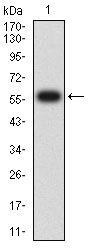 Fig1: Western blot analysis of CD1C against human CD1C (AA: extra 18-302) recombinant protein. Proteins were transferred to a PVDF membrane and blocked with 5% BSA in PBS for 1 hour at room temperature. The primary antibody ( 1/500) was used in 5% BSA at room temperature for 2 hours. Goat Anti-Mouse IgG - HRP Secondary Antibody at 1:5,000 dilution was used for 1 hour at room temperature.