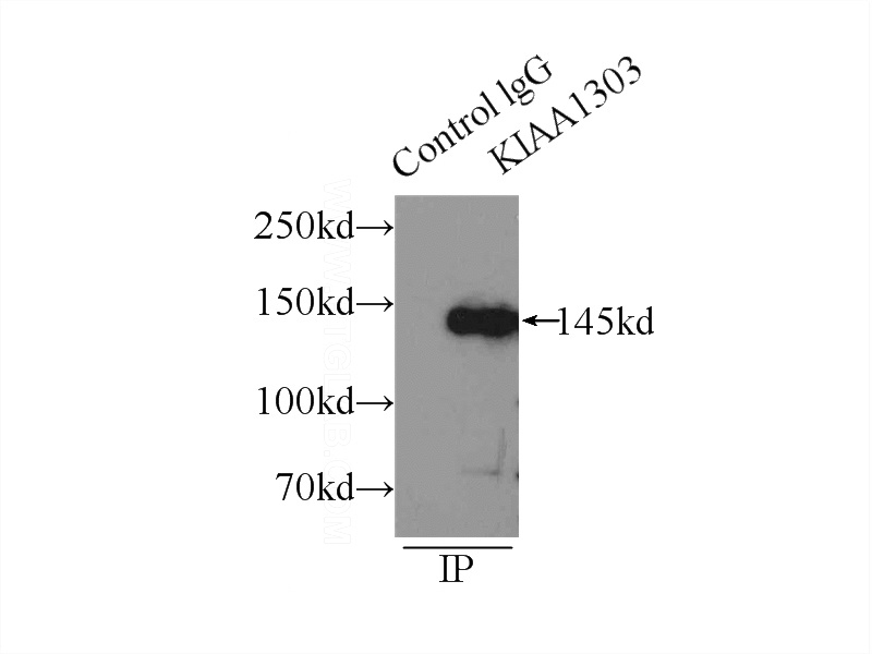 IP Result of anti-Raptor (IP:Catalog No:114467, 4ug; Detection:Catalog No:114467 1:1000) with HeLa cells lysate 1505ug.