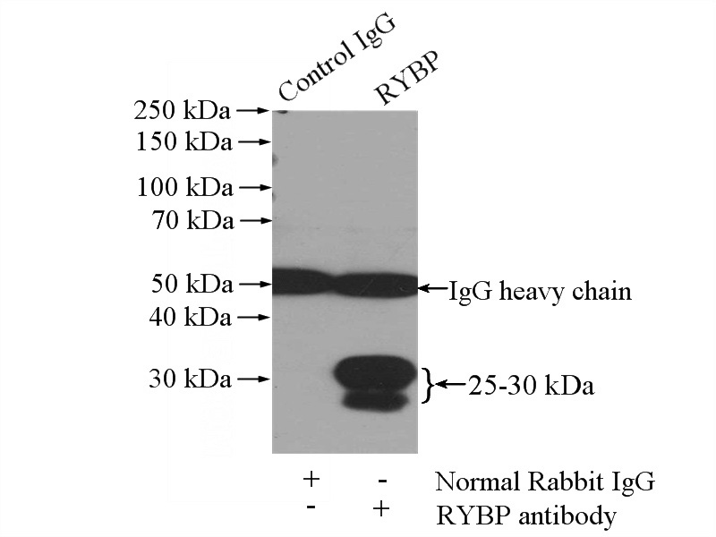 IP Result of anti-RYBP (IP:Catalog No:114950, 4ug; Detection:Catalog No:114950 1:300) with mouse spleen tissue lysate 4000ug.