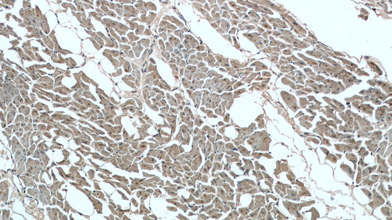 Immunohistochemistry of paraffin-embedded human heart tissue slide using Catalog No:114949(RYR2 Antibody) at dilution of 1:200 (under 10x lens).