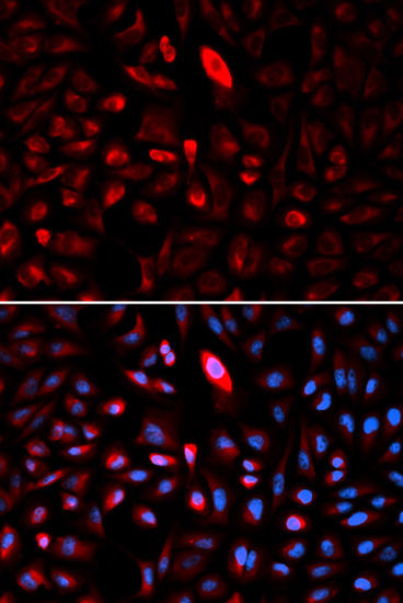 Immunofluorescence - TCP1 Polyclonal Antibody 