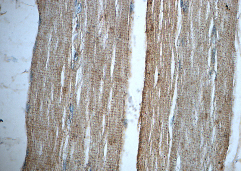 Immunohistochemistry of paraffin-embedded human skeletal muscle slide using Catalog No:115065(SAR1A Antibody) at dilution of 1:50