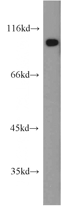 mouse eye tissue were subjected to SDS PAGE followed by western blot with Catalog No:113666(PDE6B antibody) at dilution of 1:1000