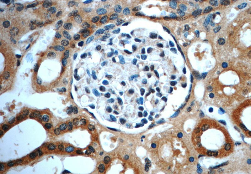Immunohistochemistry of paraffin-embedded human kidney slide using Catalog No:111012(GNRHR2 Antibody) at dilution of 1:50